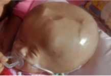 Radhitya Bagas Saputra Membutuhkan Uluran tangan Paradermawan.