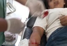 Diduga Korban Begal, Warga Desa Ratu Abung Dilarikan ke Klinik Alami Luka Bacok