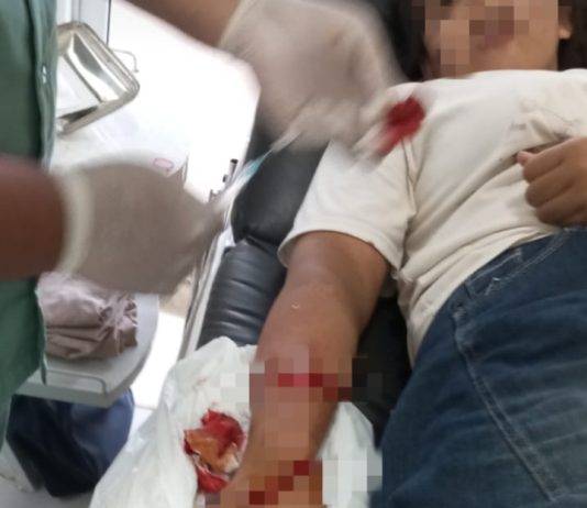 Diduga Korban Begal, Warga Desa Ratu Abung Dilarikan ke Klinik Alami Luka Bacok